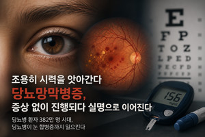 당뇨 환자 4명 중 1명은 "조용히 시력을 잃고 있는 중" - 뉴스 썸네일 이미지