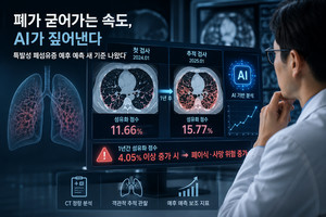 의료진 눈에 의존했던 '폐 섬유화' 진단, 예측 AI가 싹 잡는다